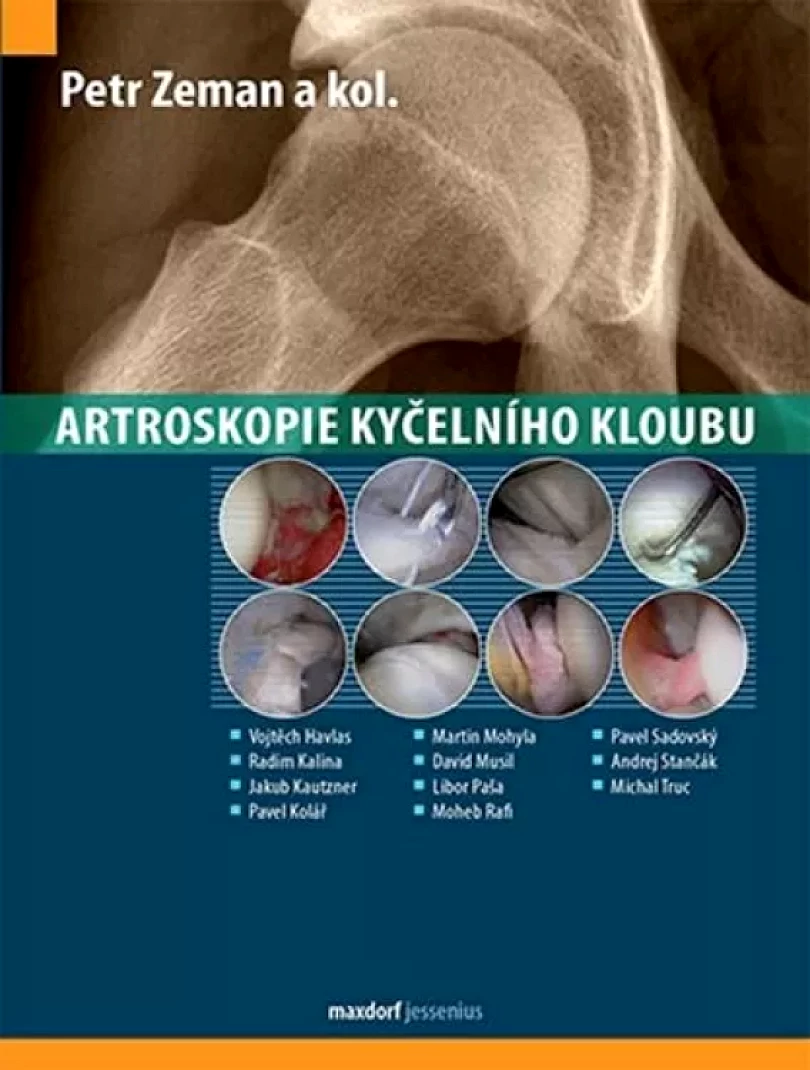 Levně Artroskopie kyčelního kloubu (Petr Zeman, 2016)