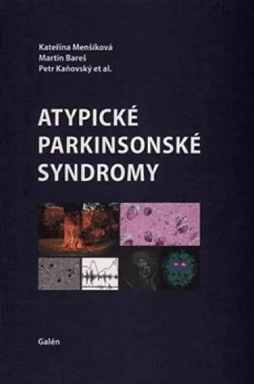 Atypické parkinsonské syndromy (Kateřina Menšíková, 2015)