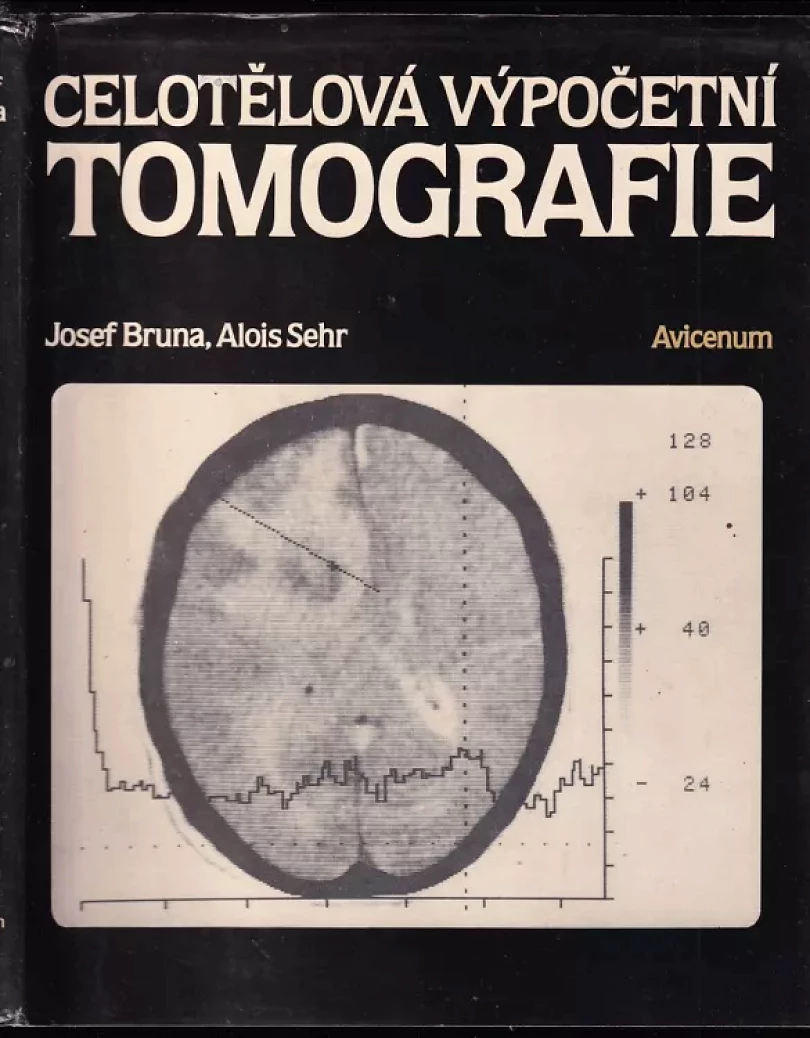 Levně Celotělová výpočetní tomografie (Josef Brůna, 1988)