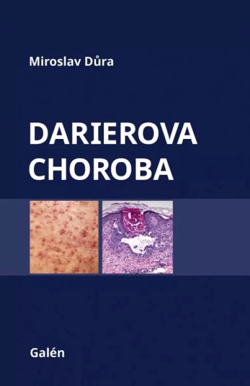 Levně Darierova choroba (Miroslav Důra, 2021)
