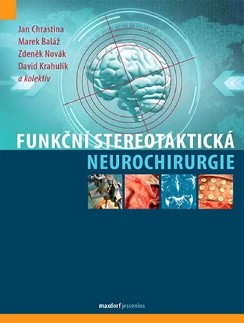 Funkční stereotaktická neurochirurgie (Jan, 2019)
