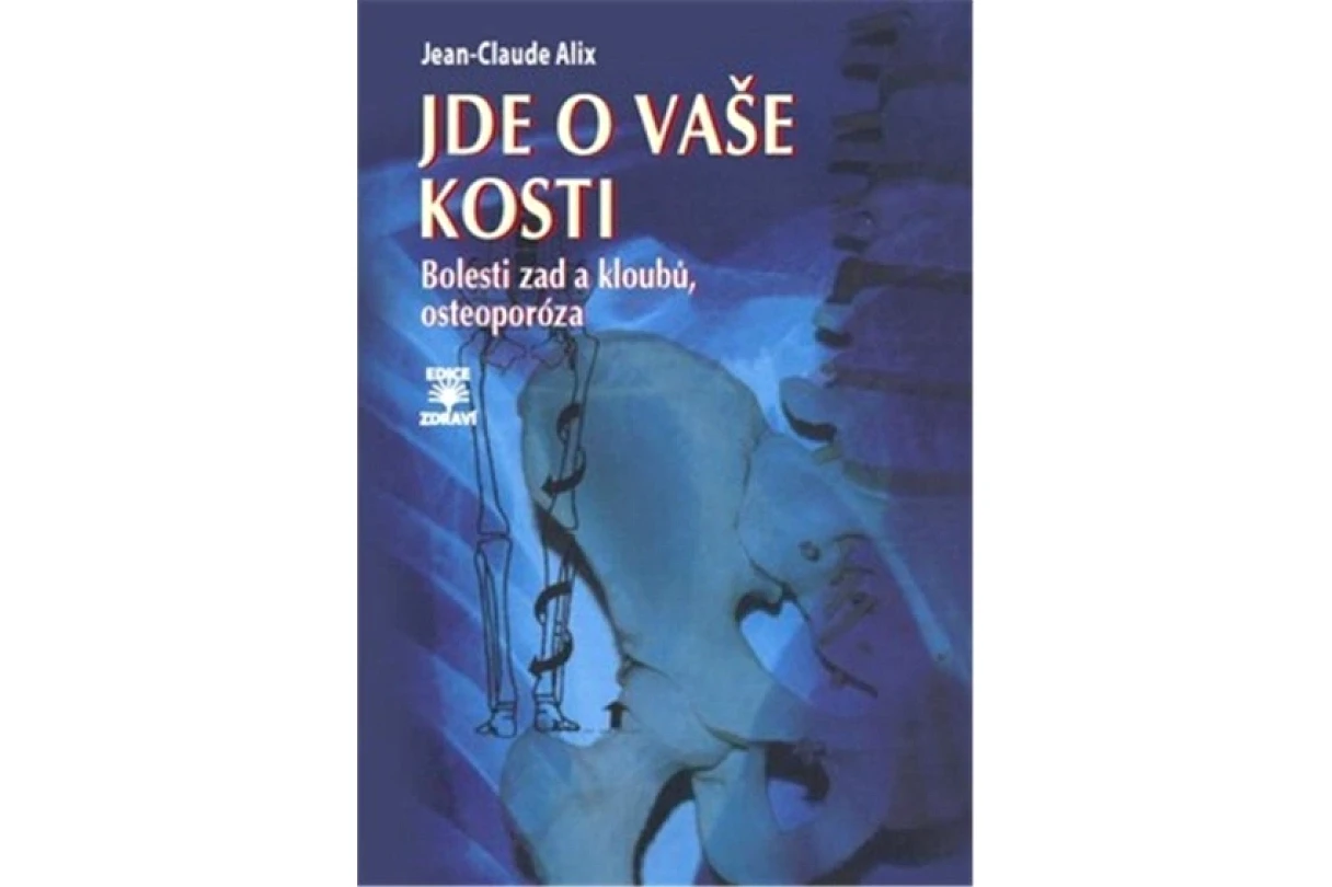 Levně Jde o vaše kosti (Jean-Claude Alix, 2016)