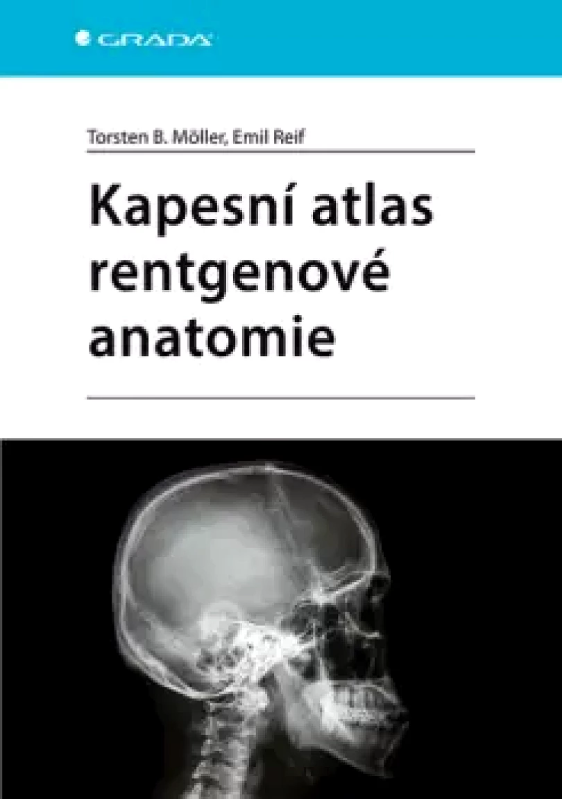 Kapesní atlas rentgenové anatomie (Torsten Möller,, 2024)