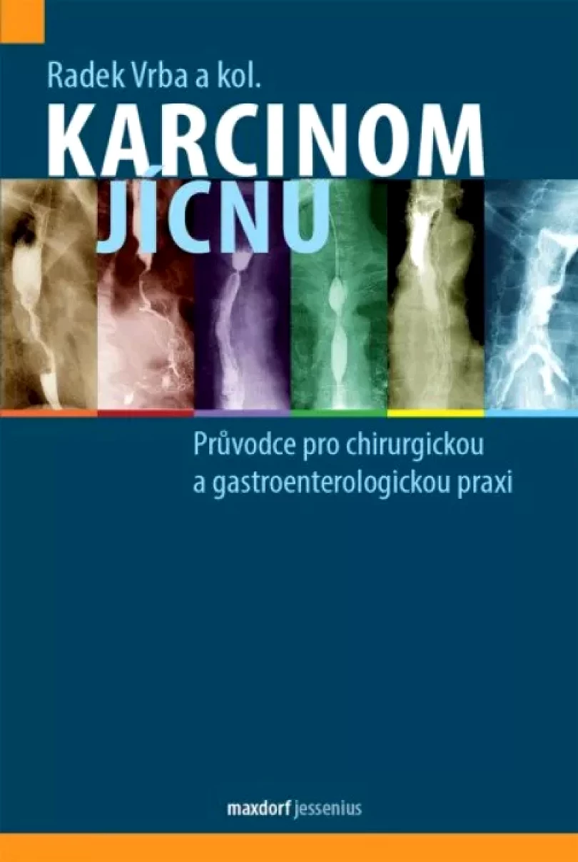 Levně Karcinom jícnu (Radek Vrba, 2021)