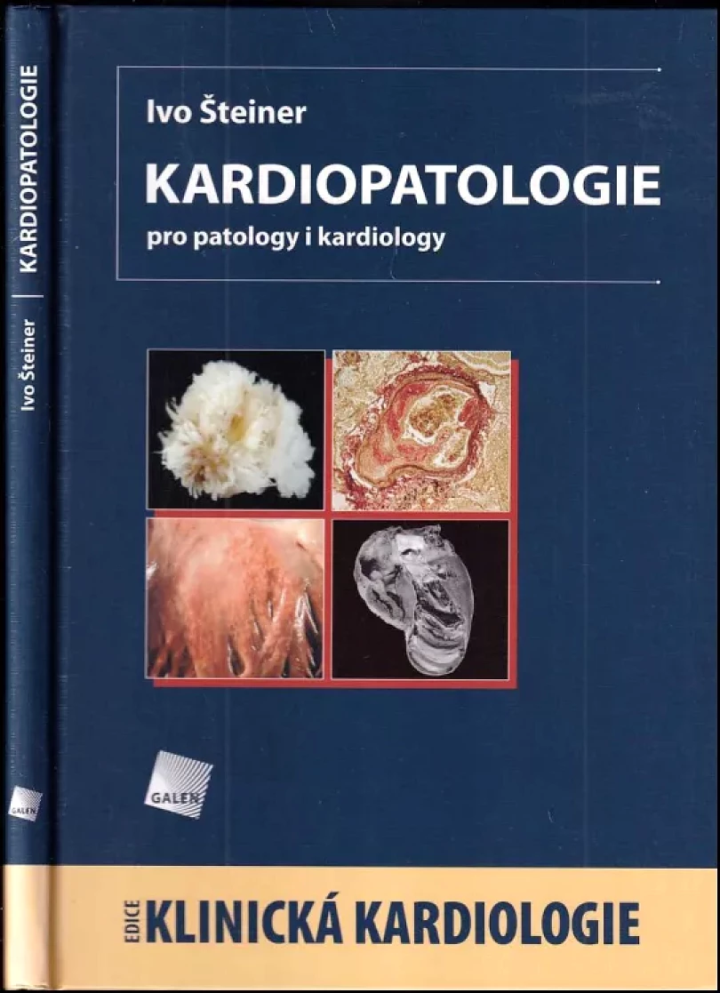 Kardiopatologie (Ivo Šteiner, 2010)