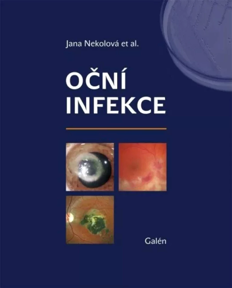 Levně Oční infekce (, 2021)
