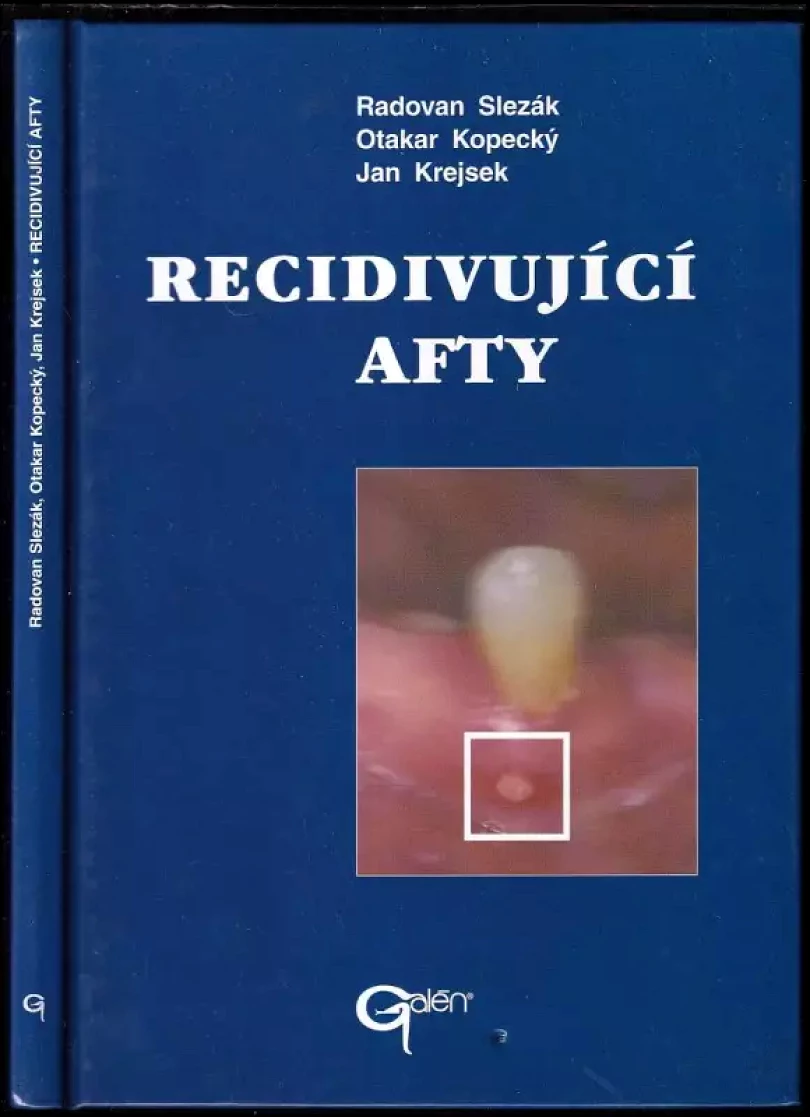 Recidivující afty (Otakar Kopecký, 2000)