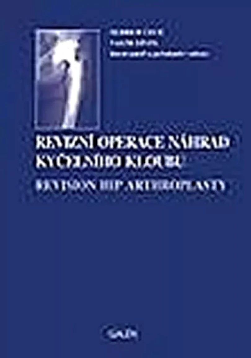Levně Revizní operace náhrad kyčelního kloubu (Oldřich Čech, 2004)