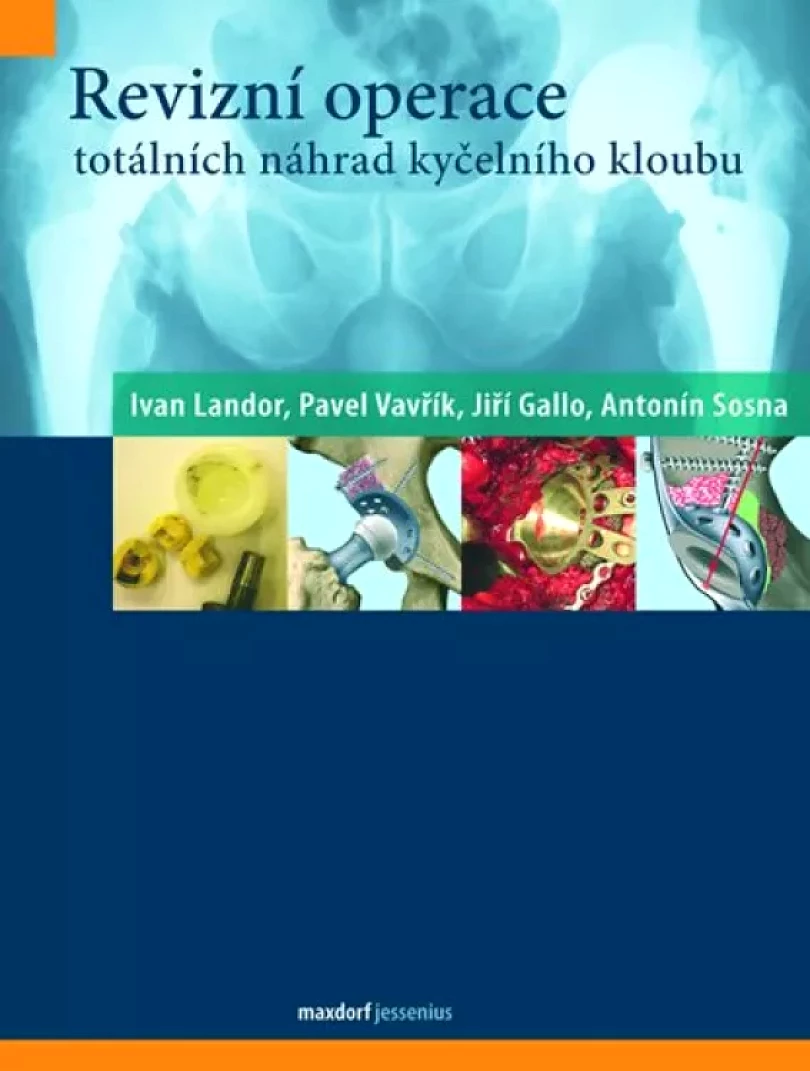 Levně Revizní operace totálních náhrad kyčelního kloubu (Ivan Landor, 2012)