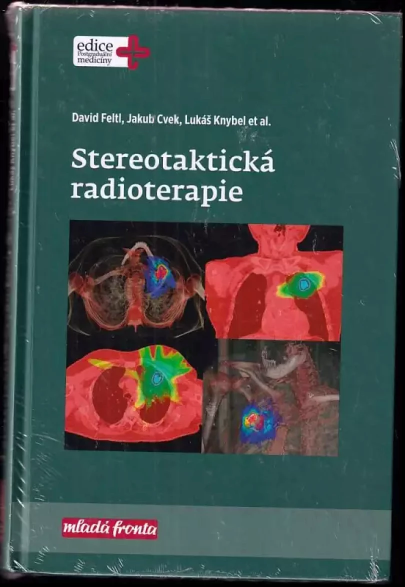 Levně Stereotaktická radioterapie (David Feltl, 2019)