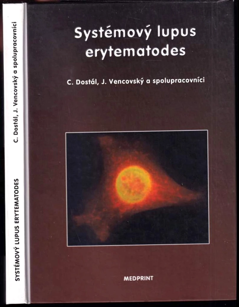 Systémový lupus erytematodes (Jiří Vencovský, 1997)