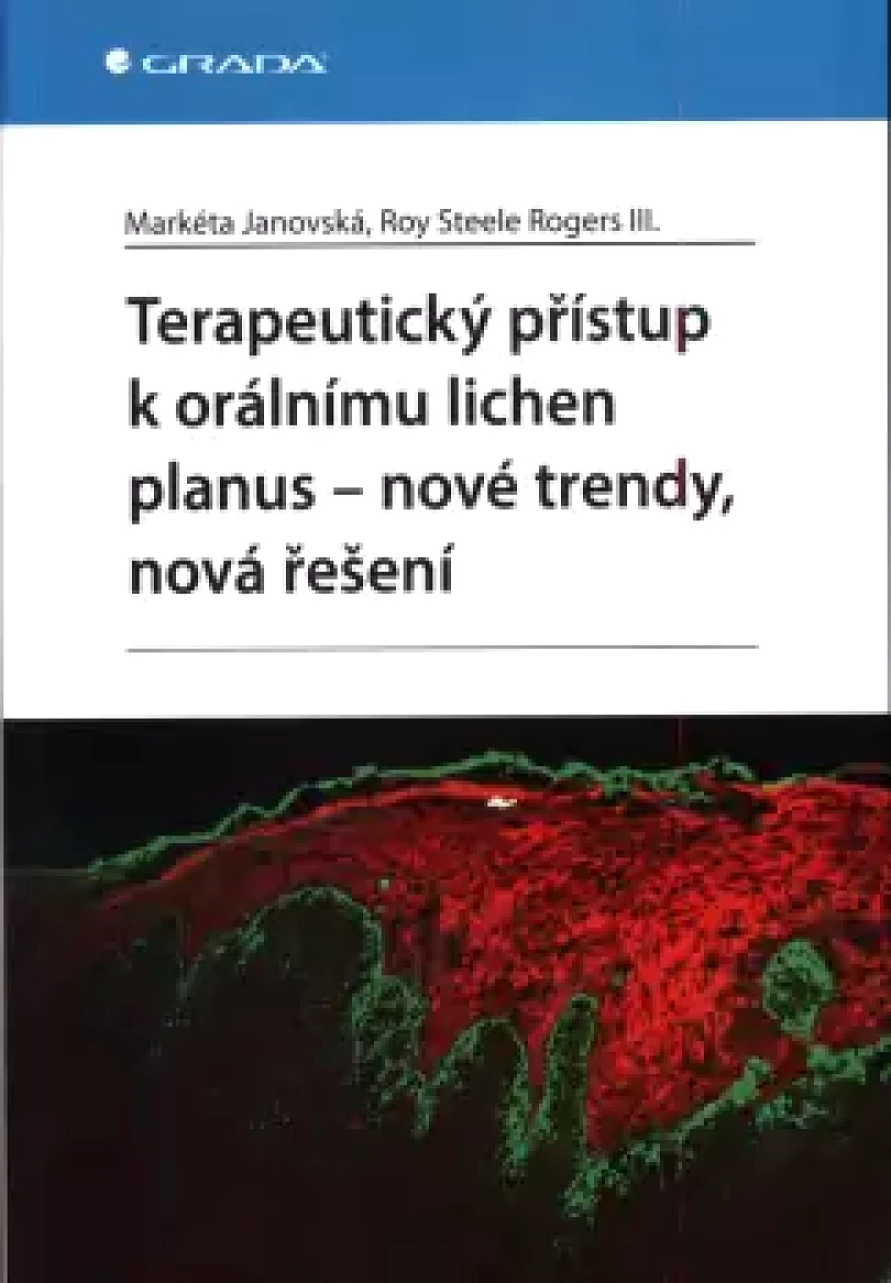 Levně Terapeutický přístup k orálnímu lichen planus - nové trendy, nová řešení (Markéta Janovská, 2024)