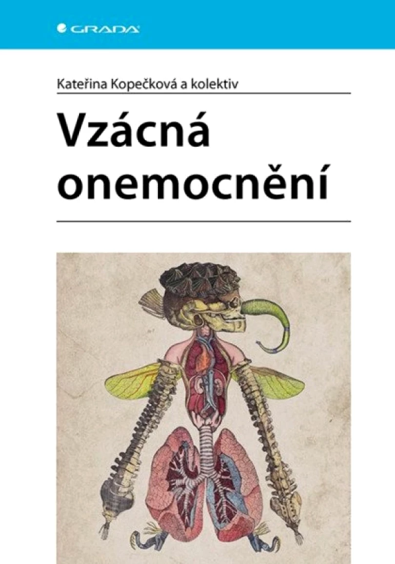 Vzácná onemocnění (Kateřina Kopečková, 2025)