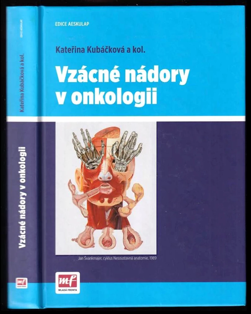 Vzácné nádory v onkologii (Kateřina Kubáčková, 2015)