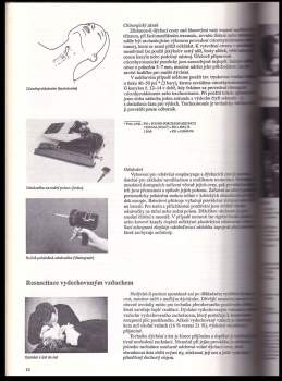 ABC o resuscitaci