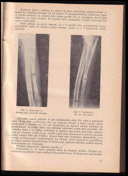 Miroslav Jaroš: Acta chirurgiae orthopaedicae et traumatologiae Čechoslovaca, ROČNÍK XXIV.