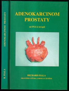Jaroslav Ženíšek: Adenokarcinom prostaty