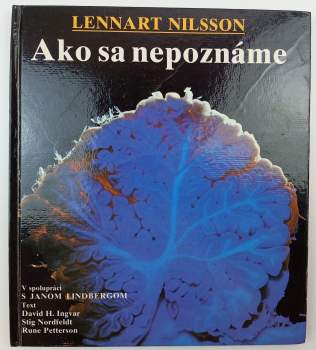 Ako sa nepoznáme