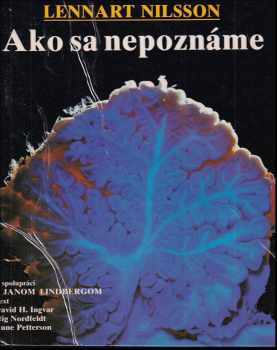 Ako sa nepoznáme
