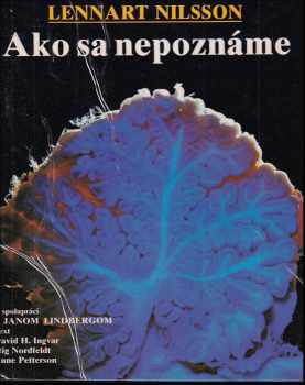 David H Ingvar: Ako sa nepoznáme : objavná cesta s fotografickým aparátom do nášho tela