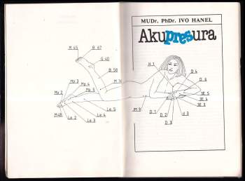 Akupresura