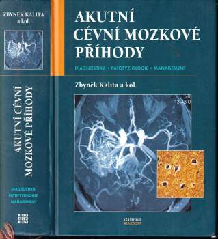 Zbyněk Kalita: Akutní cévní mozkové příhody