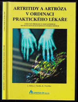 Artritidy a artróza v ordinaci praktického lékaře