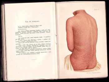 František Mráček: Atlas kožních chorob