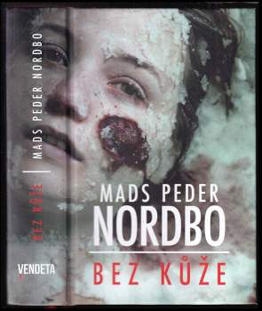 Mads Peder Nordbo: Bez kůže