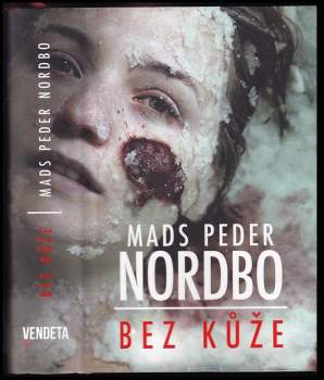 Mads Peder Nordbo: Bez kůže