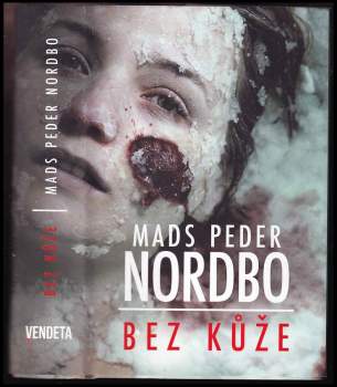 Mads Peder Nordbo: Bez kůže