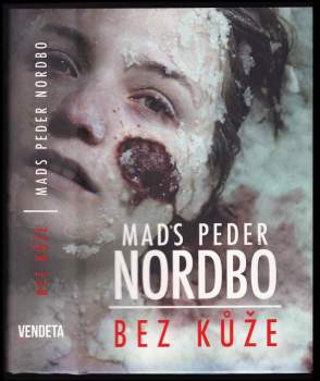 Mads Peder Nordbo: Bez kůže