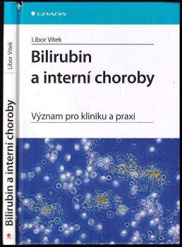 Libor Vítek: Bilirubin a interní choroby