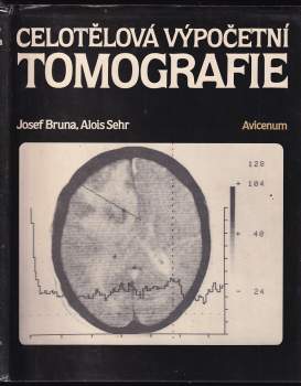 Josef Brůna: Celotělová výpočetní tomografie