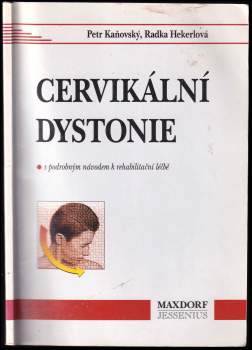 Cervikální dystonie a její léčba
