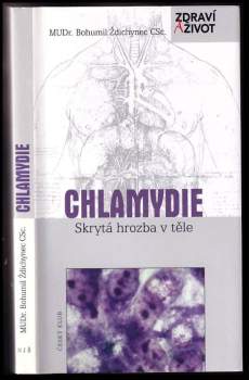 Chlamydie