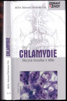 Chlamydie