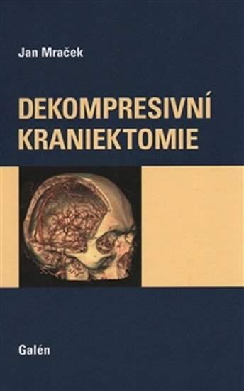 Dekompresní kraniektomie