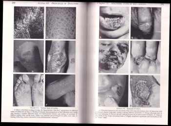 Donald M. Pillsbury: Dermatology