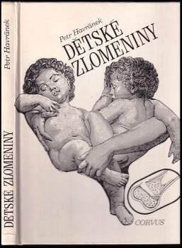 Dětské zlomeniny