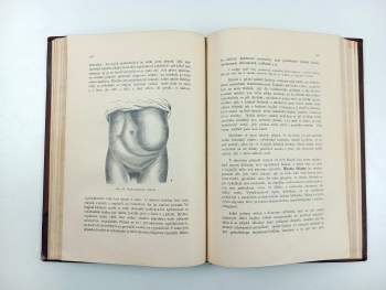 Eduard Albert: Diagnostika nemocí chirurgických