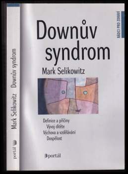 Downův syndrom