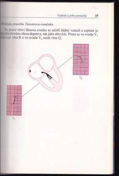 John R Hampton: EKG