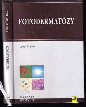 Fotodermatózy