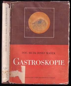 Gastroskopie