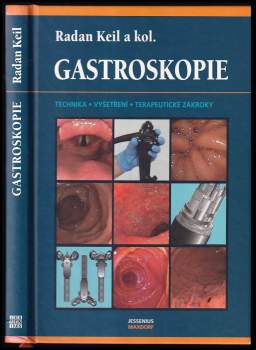Gastroskopie