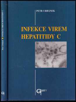 Infekce virem hepatitidy C