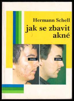 Hermann Schell: Jak se zbavit akné