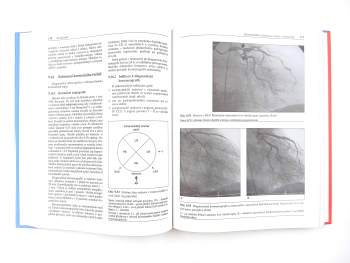 Miloš Štejfa: Kardiologie