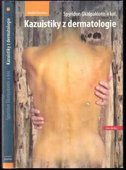 Spyridon Gkalpakiotis: Kazuistiky z dermatologie